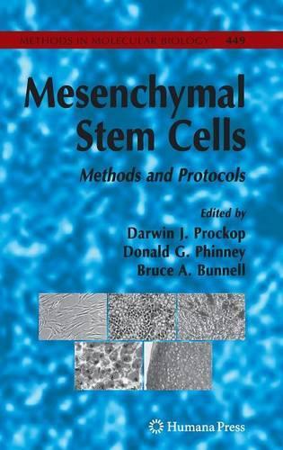Mesenchymal Stem Cells