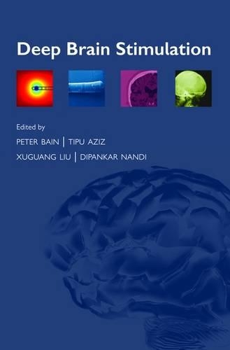 Deep Brain Stimulation: (English)