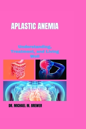 Aplastic Anemia
