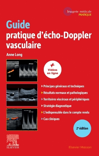 Guide Pratique d'Écho-Doppler Vasculaire