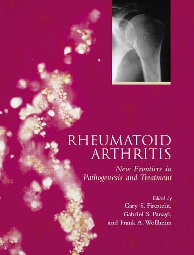 Rheumatoid Arthritis