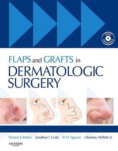 Flaps and Grafts in Dermatologic Surgery E-Book