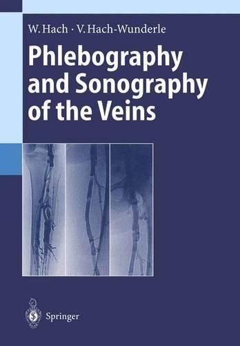 Phlebography and Sonography of the Veins