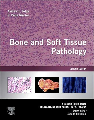 Bone and Soft Tissue Pathology E-Book