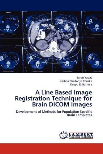 A Line Based Image Registration Technique for Brain Dicom Images