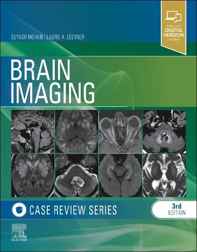 Brain Imaging: Case Review Series(Case Review)