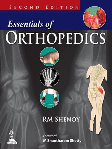 Essentials of Orthopedics