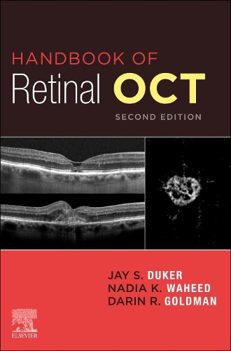 Handbook of Retinal Oct: Optical Coherence Tomography E-Book