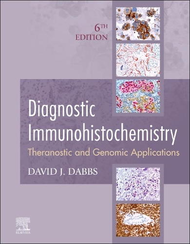 Diagnostic Immunohistochemistry E-Book: Diagnostic Immunohistochemistry E-Book