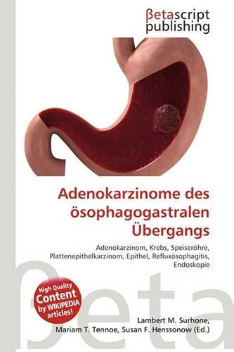 Adenokarzinome Des Osophagogastralen Bergangs