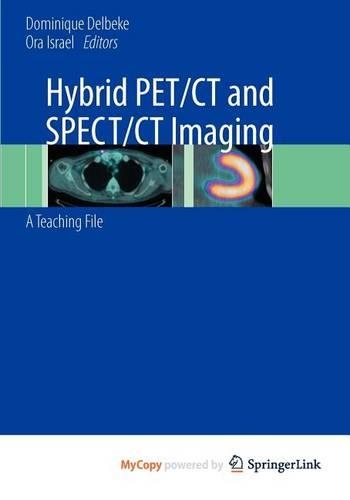 Hybrid Pet/CT and Spect/CT Imaging: (English)