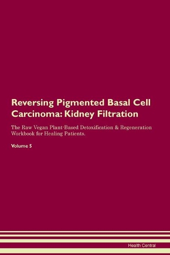Reversing Pigmented Basal Cell Carcinoma
