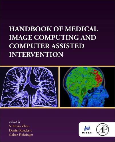 Handbook of Medical Image Computing and Computer Assisted Intervention: (The MICCAI Society book Series)