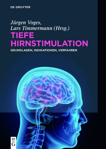 Tiefe Hirnstimulation: Grundlagen, Indikationen, Verfahren(German)