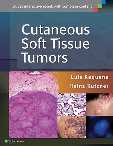 Cutaneous Soft Tissue Tumors: (English)