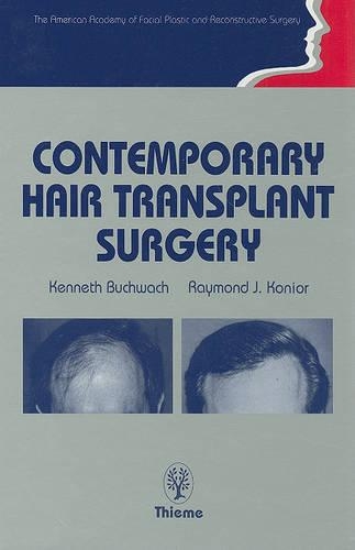 Contemporary Hair Transplant Surgery