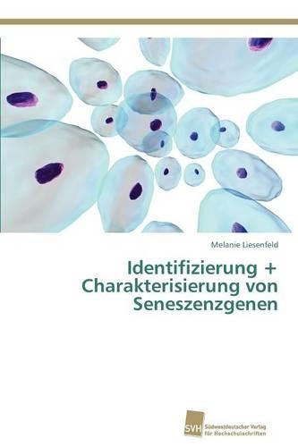 Identifizierung + Charakterisierung von Seneszenzgenen: (German)