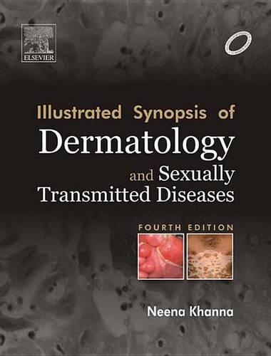 Illustrated Synopsis of Dermatology & Sexually Transmitted Diseases - E-Book