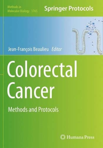 Colorectal Cancer