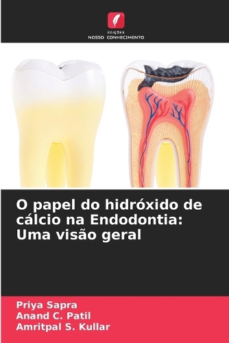 O papel do hidróxido de cálcio na Endodontia: Uma visão geral