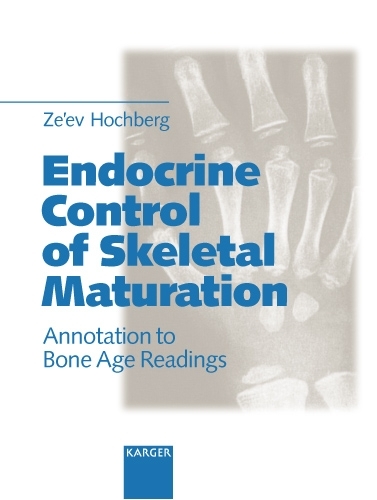 Endocrine Control of Skeletal Maturation: Annotation to Bone Age Readings
