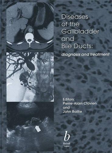 Diseases of the Gallbladder and Bile Ducts