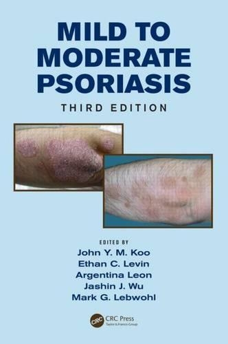 Mild to Moderate Psoriasis, Third Edition