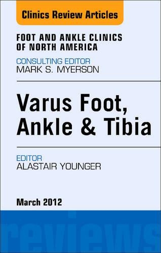 Varus Foot, Ankle, and Tibia, an Issue of Foot and Ankle Clinics