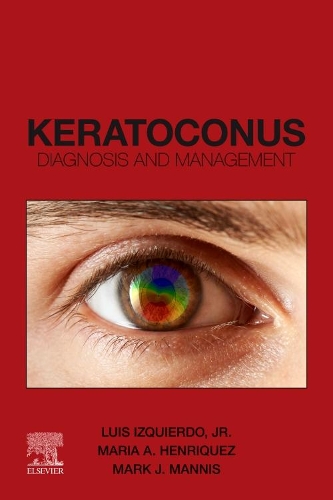 Keratoconus