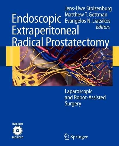 Endoscopic Extraperitoneal Radical Prostatectomy