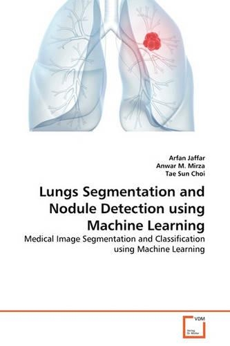 Lungs Segmentation and Nodule Detection using Machine Learning