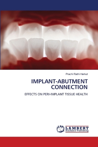 Implant-Abutment Connection