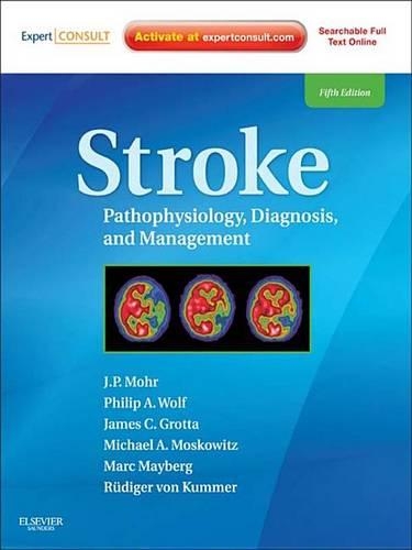 Stroke E-Book