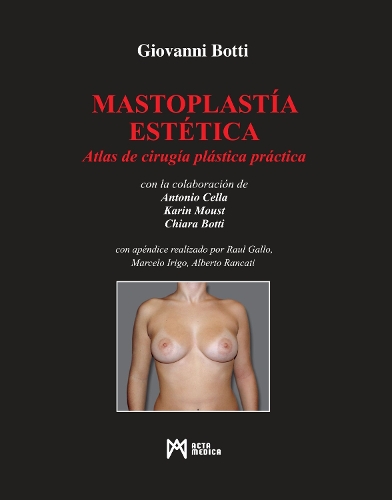 Mastoplastía Estética