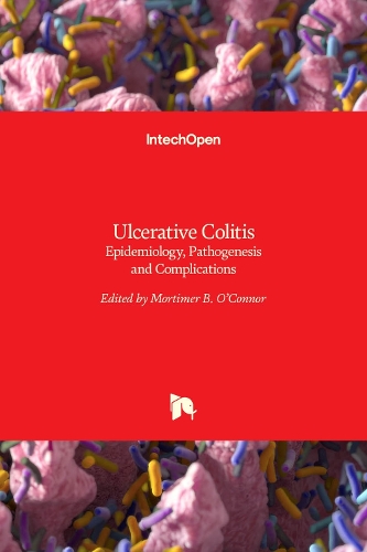 Ulcerative Colitis