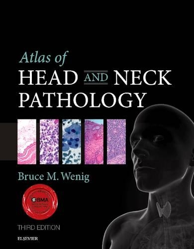 Atlas of Head and Neck Pathology E-Book