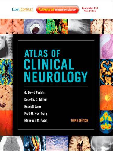 Atlas of Clinical Neurology E-Book