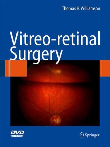 Vitreoretinal Surgery