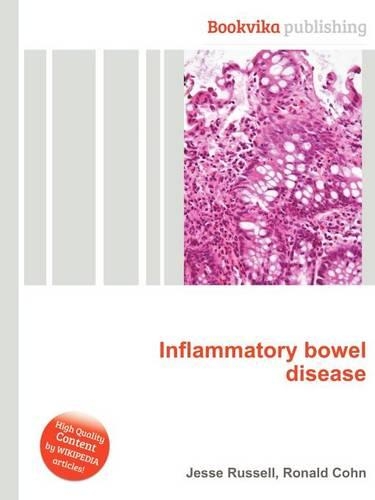 Inflammatory Bowel Disease