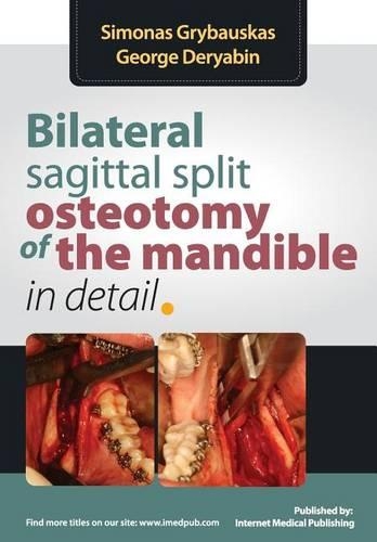 Bilateral Sagittal Split Oesteotomy of the Mandible in Detail: (English)