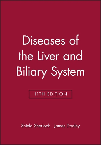 Diseases of the Liver and Biliary System
