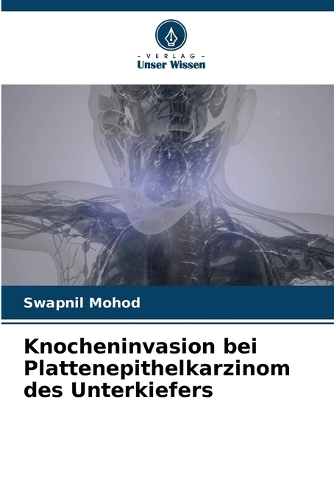 Knocheninvasion bei Plattenepithelkarzinom des Unterkiefers
