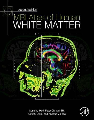 MRI Atlas of Human White Matter 2nd Edition