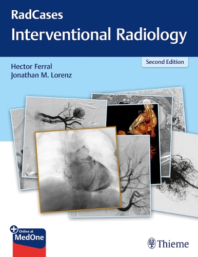 RadCases Q&a Interventional Radiology: (Radcases Plus Q&a)