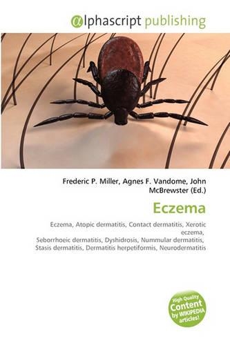 Eczema