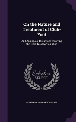 On the Nature and Treatment of Club-Foot