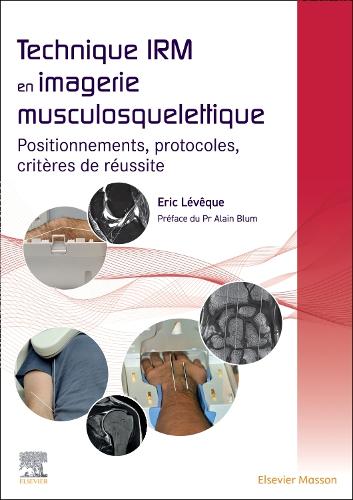 Technique Irm En Imagerie Musculosquelettique: Positionnements, Protocoles, Critères de Réussite