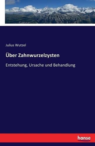 Über Zahnwurzelzysten: Entstehung, Ursache und Behandlung(German)