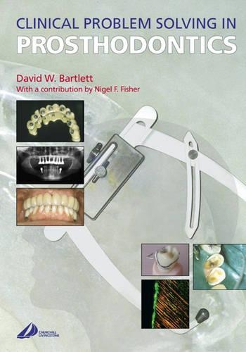 Clinical Problem Solving in Prosthodontics