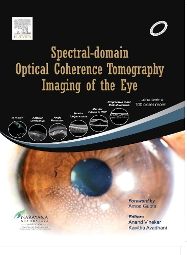 Spectral-Domain Optical Coherence Tomography Imaging of the Eye